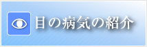 眼の病気の紹介